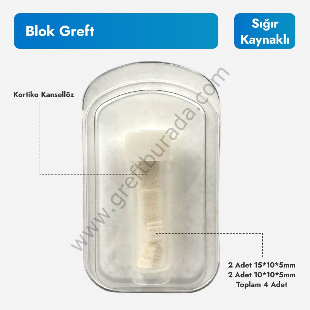 Blok Greft - Sığır Kaynaklı