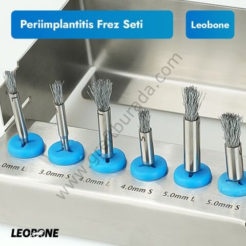 Peri-implantitis Frez Seti