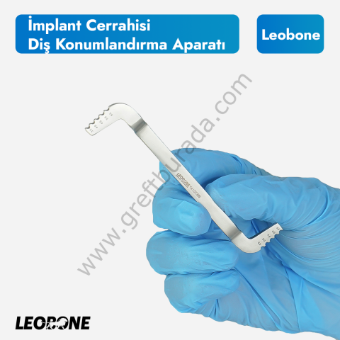 İmplant Kılavuzu | Diş Konumlandırma Aparatı