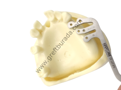 Leobone Implant Guide Kit (İmplant Konumlandırma Rehberi)