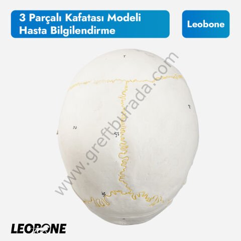3 Parçalı Kafatası Modeli | Hasta Bilgilendirme