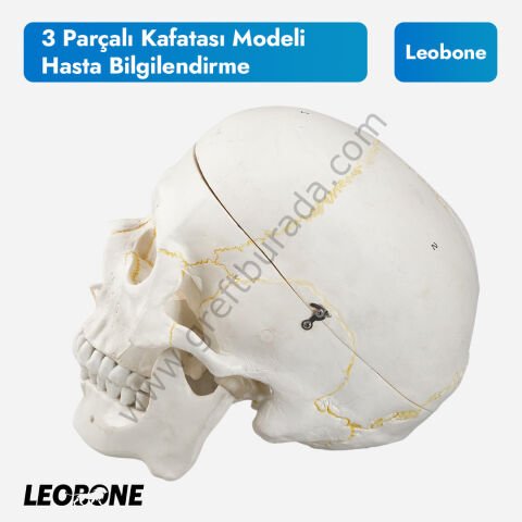 3 Parçalı Kafatası Modeli | Hasta Bilgilendirme
