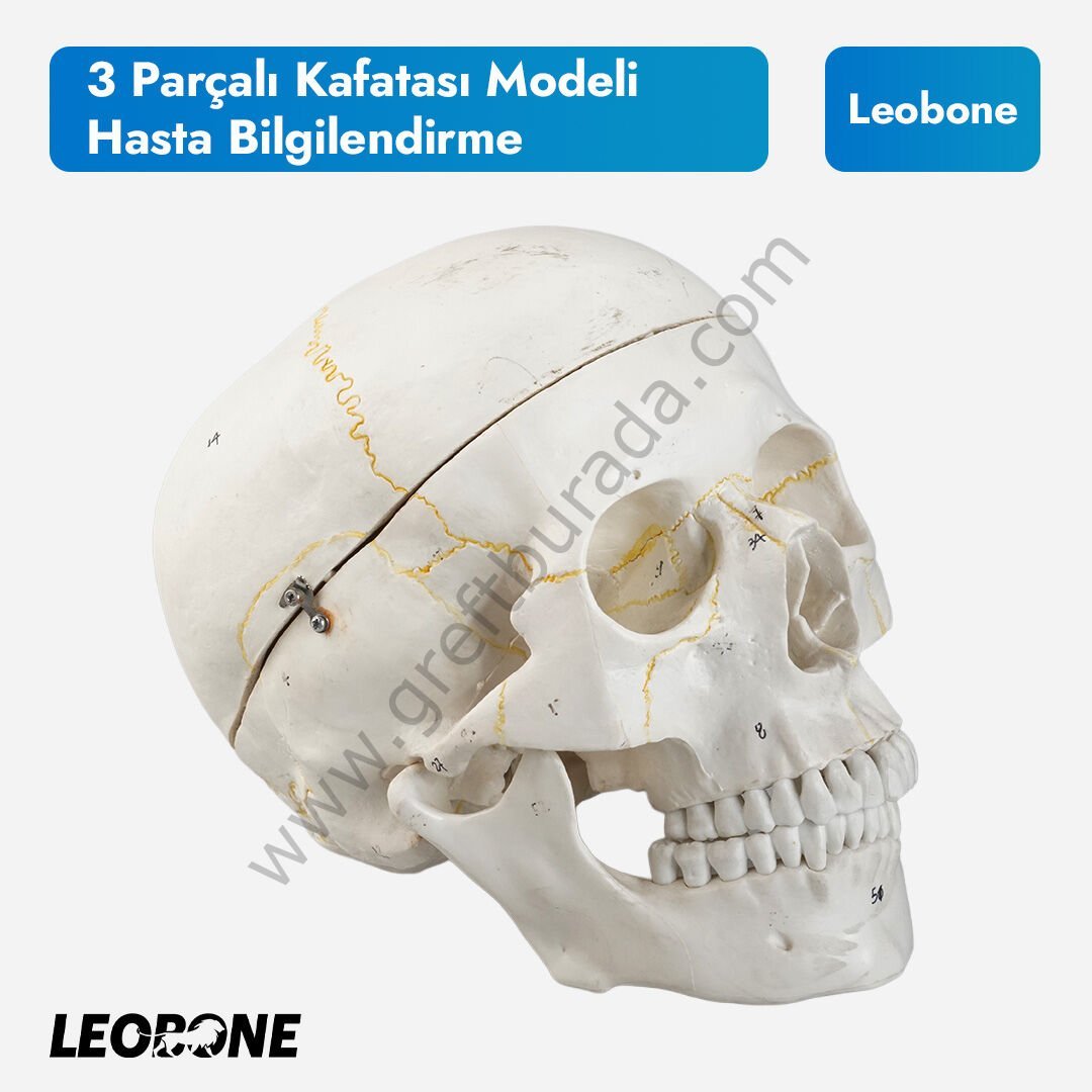 3 Parçalı Kafatası Modeli | Hasta Bilgilendirme