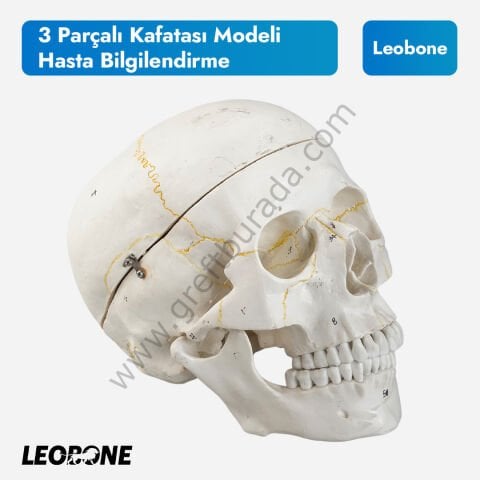 3 Parçalı Kafatası Modeli | Hasta Bilgilendirme