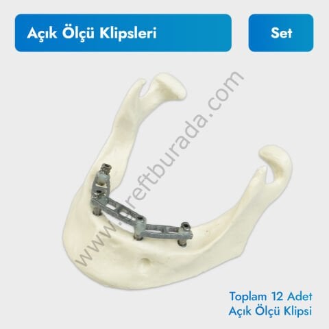 Açık Ölçü Klipsleri