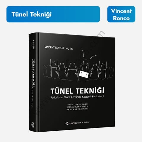 Tünel Tekniği: Periodontal Plastik Cerrahide Kapsamlı Bir Konsept