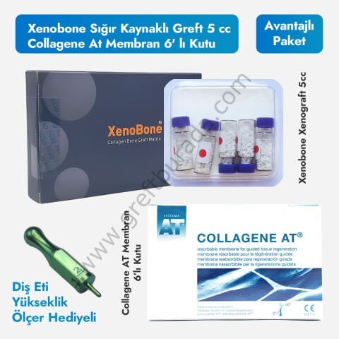 Xenobone Sığır Kaynaklı Greft 5 cc (0.7-1.5mm Partikül)+ Collagene At Membran 6' lı Kutu