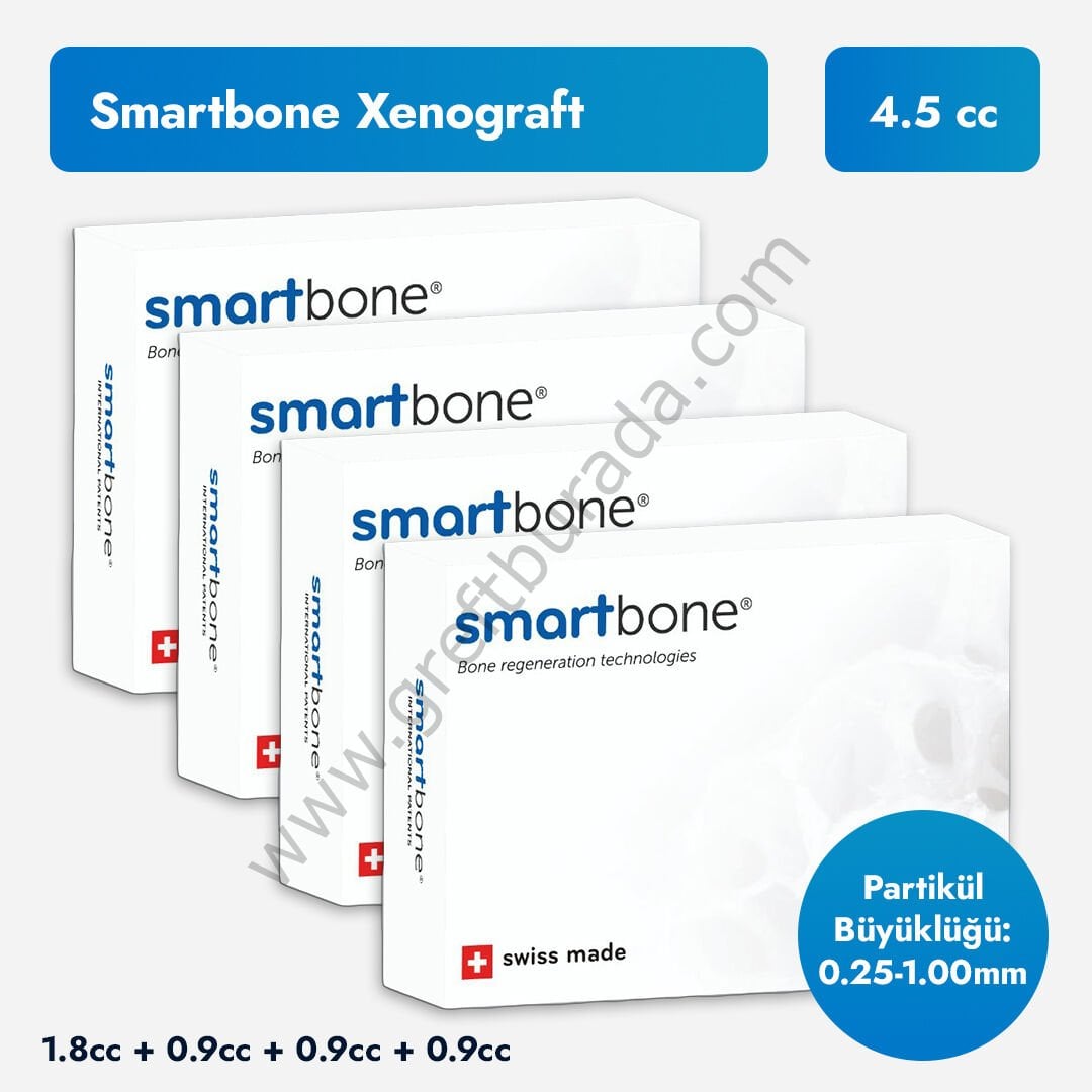 SmartBone Sığır Kaynaklı Kemik Grefti | 4 Kutu-4.5cc | 0.25-1 mm