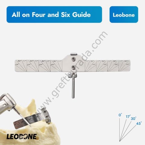 Leobone All on Four Guide (All on Six İmplant Açı Kılavuzu)