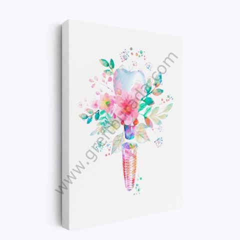 Dental Tablo - WATERCOLOR IMPLANT 40X60 CM KANVAS TABLO