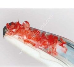 Meta Safescraper Twist Kemik Kazıyıcı Adet