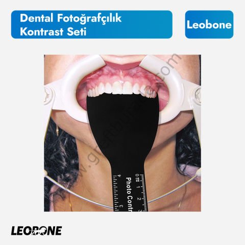 Otoklavlanabilir Dental Fotoğrafçılık Kontrast Plaka Seti