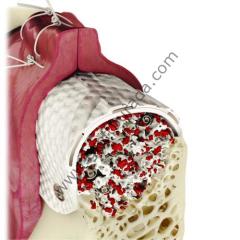 Cytoplast Titanyum Destekli (PTFE) Membran