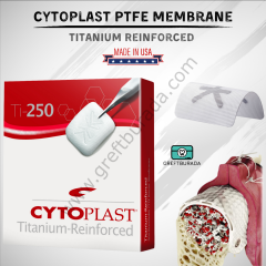 Osteogenics Cytoplast Titanyum Destekli PTFE Membran