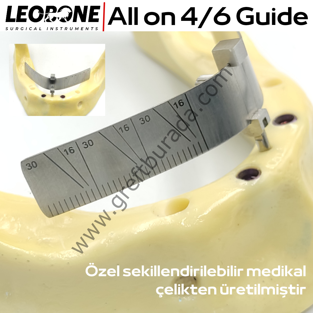 All on four and six guide