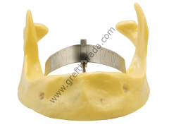 All on four and six guide