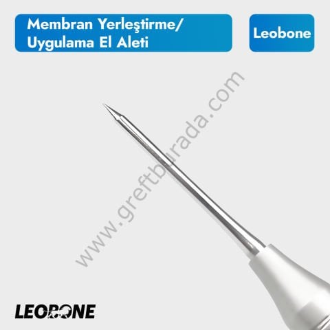 Membran Yerleştirme ve Uygulama El Aleti