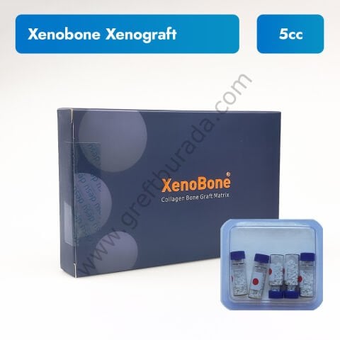 Xenobone Sığır Kaynaklı Greft 5 cc | 0.7-1.5mm Partikül
