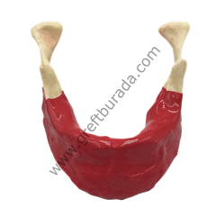 Silikon Kaplı (Diş etli) Mandibüla Dişsiz Çene Modeli