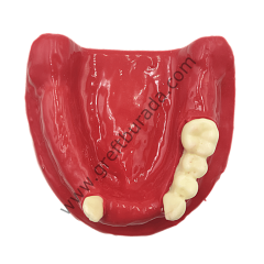 Tamamı Silikon (diş etli) İmplant Eğitim Çene Modeli