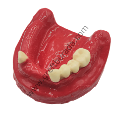 Tamamı Silikon (diş etli) İmplant Eğitim Çene Modeli