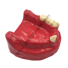 Tamamı Silikon (diş etli) İmplant Eğitim Çene Modeli