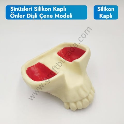 Sinüsleri Silikon Kaplı Önler Dişli Çene Modeli