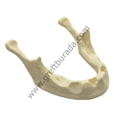 Defekte Mandibüla Çene Modeli