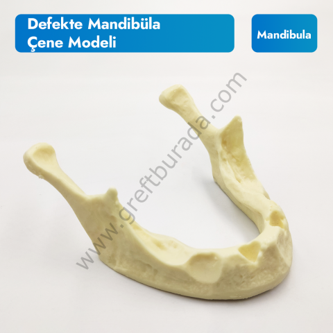 Defekte Mandibüla Çene Modeli