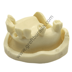 Yarı Dişli Çene Modeli